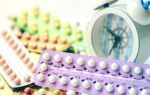 Как подобрать гормональные контрацептивы?